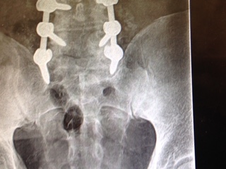 Patient image of: David Pearlman