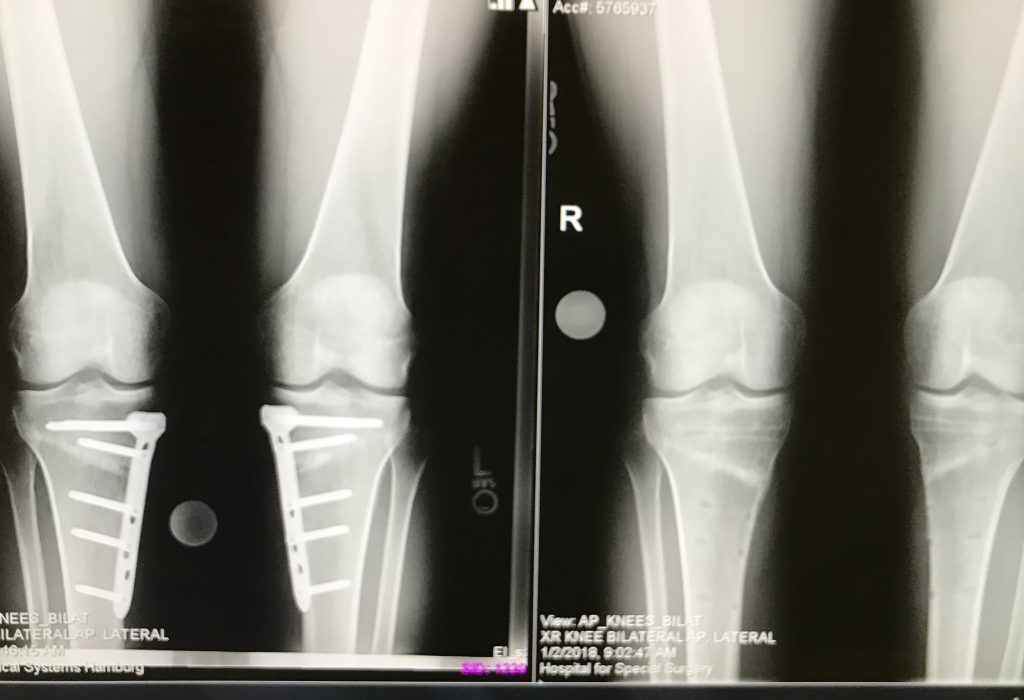 Patient image of: D. G.
