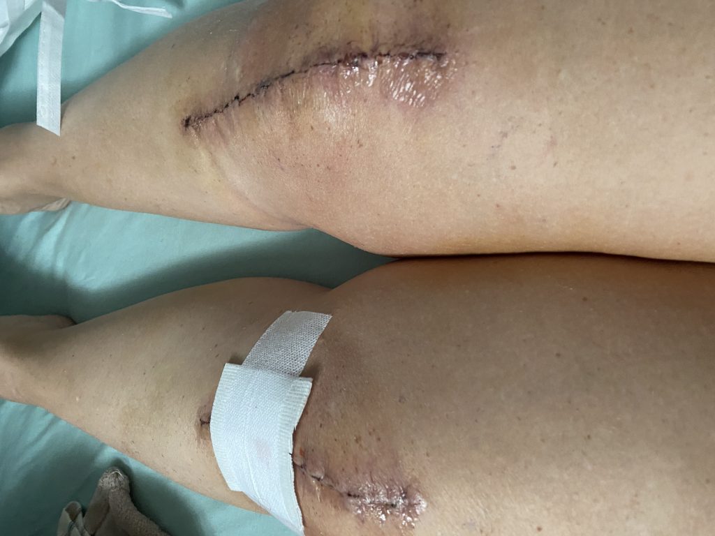 Patient image of: Norma Ruiz
