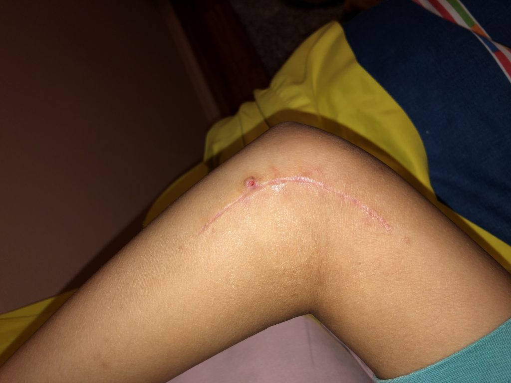 Patient image of: Sophia Cerky