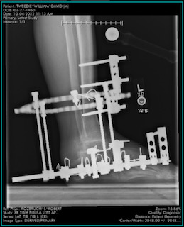 Patient image of: William Tweedie
