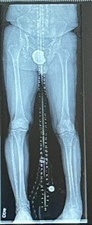 Patient image of: William Tweedie