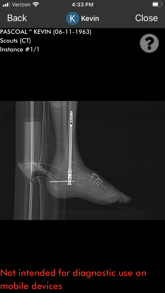 Patient image of: Kevin Pascoal