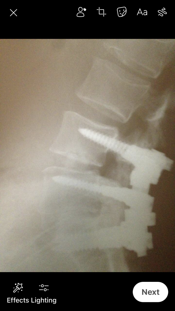 Patient image of: Linda Babadelis