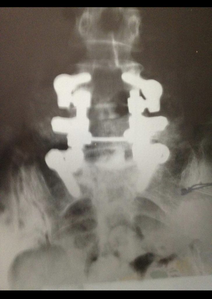 Patient image of: Linda Babadelis