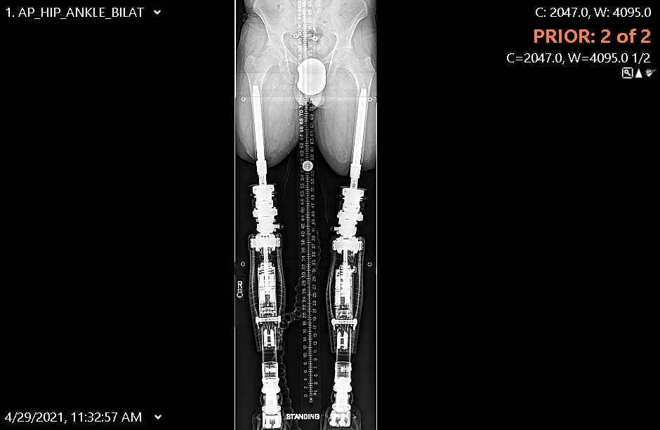Patient image of: Thamer Alatawi