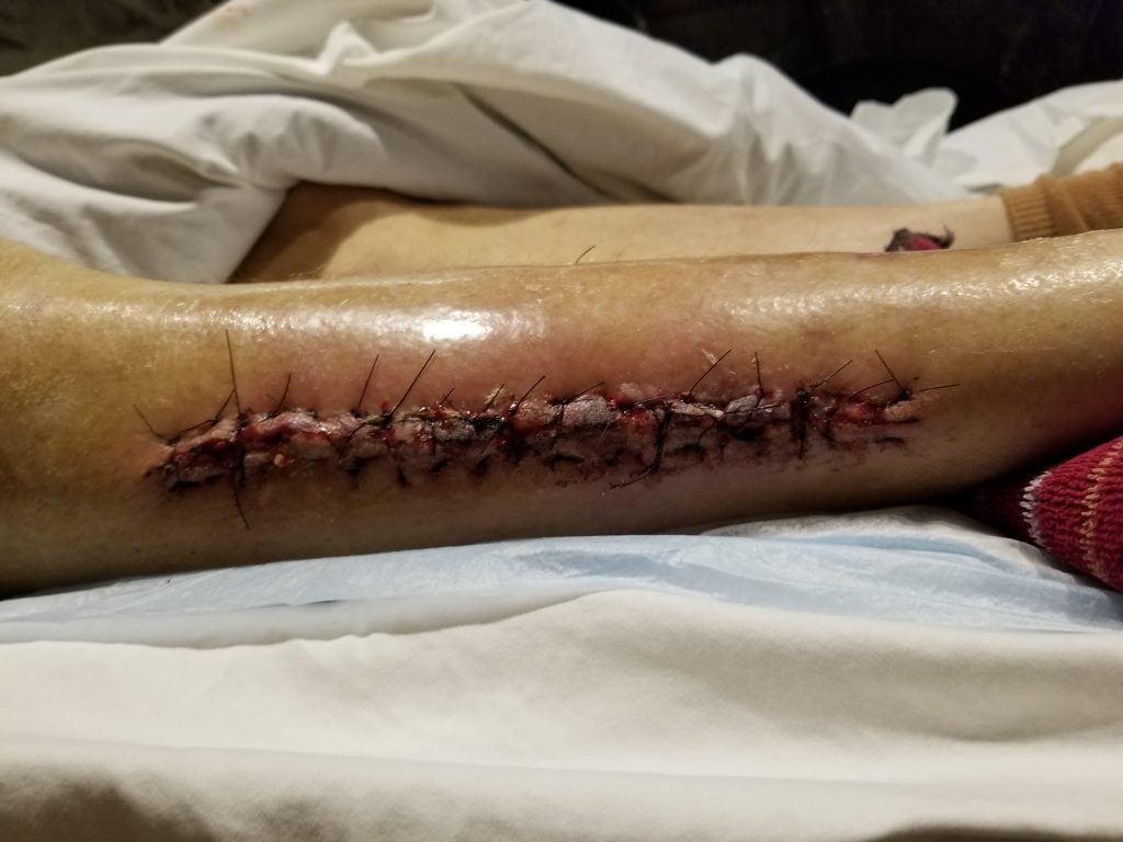 Patient image of: Warren Frank