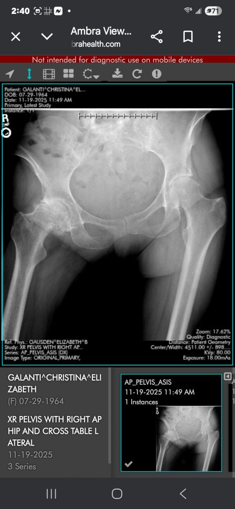 Patient image of: Christina Galanti