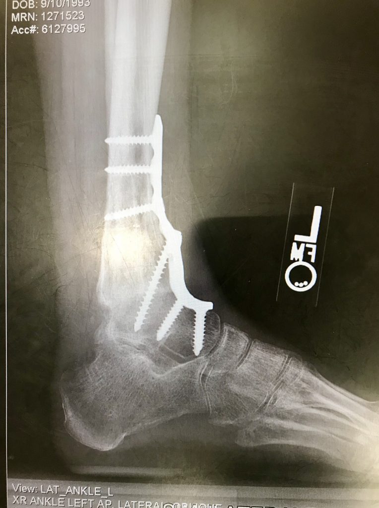 Patient image of: Emily Eschner