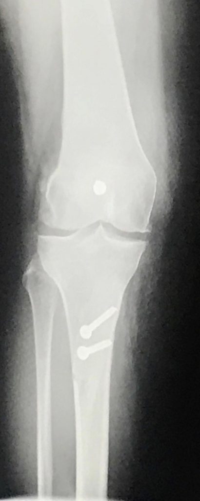 Patient image of: Allison Kingsley