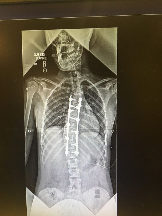 Patient image of: Alyssa Natoli