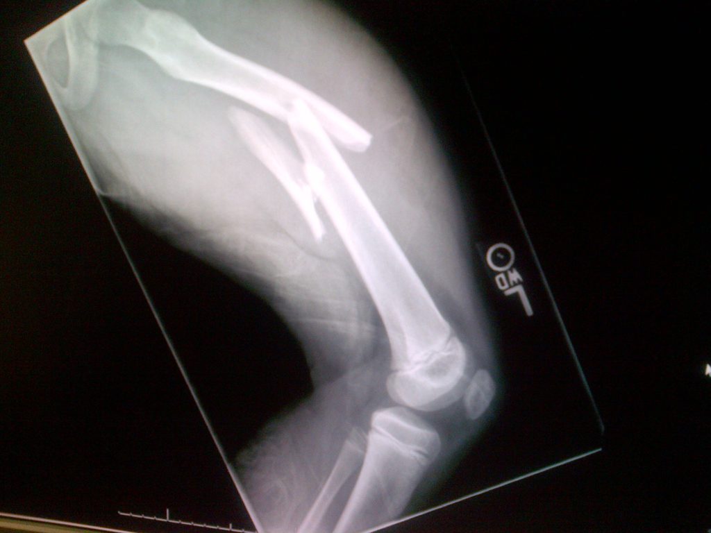 Patient image of: Caroline Madsen