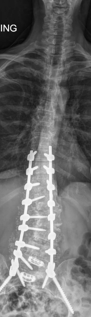 Patient image of: Donna B.