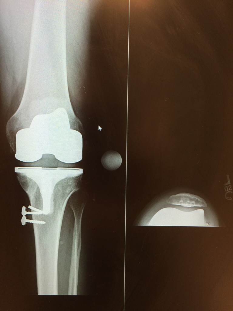 Patient image of: Mike Phillips