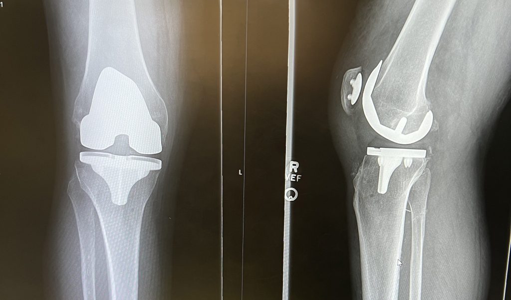 Patient image of: Richard Allen