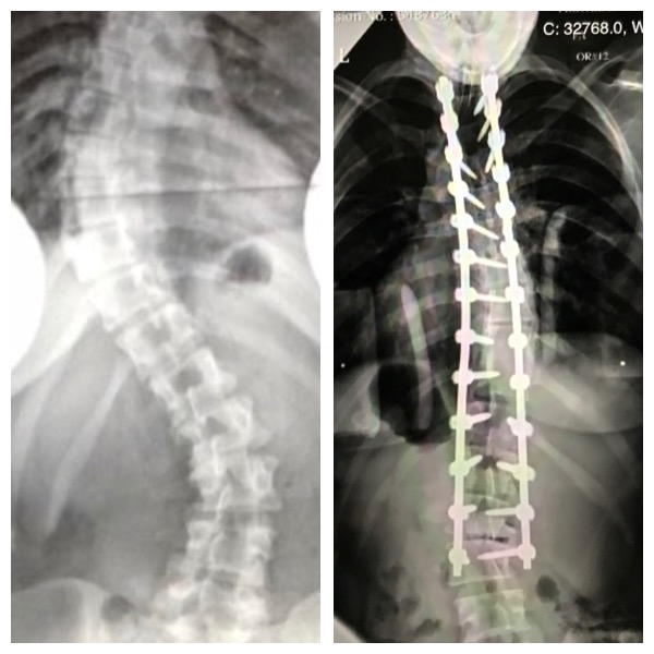 Patient image of: Rachel Ahrenhold McConnell