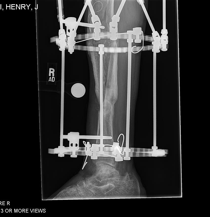 Patient image of: Henry Daniecki