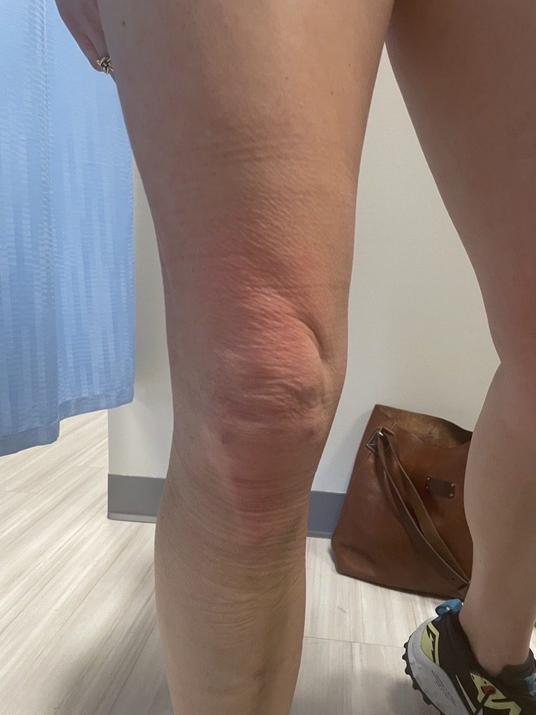Patient image of: Megan Rath