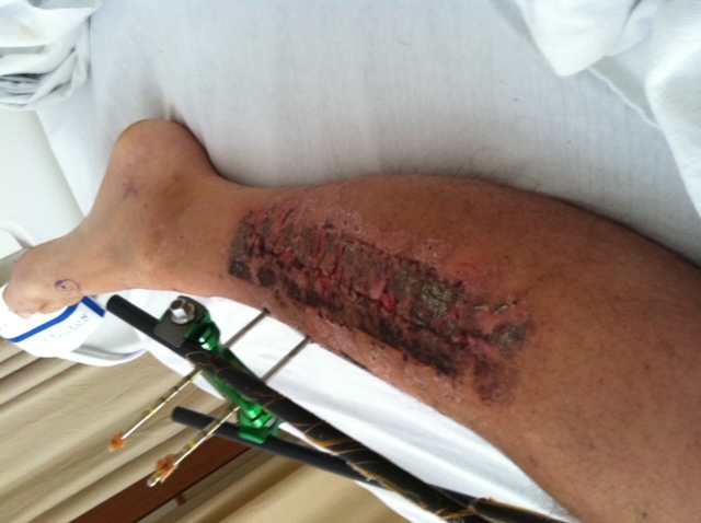 Patient image of: Steven O'Riley