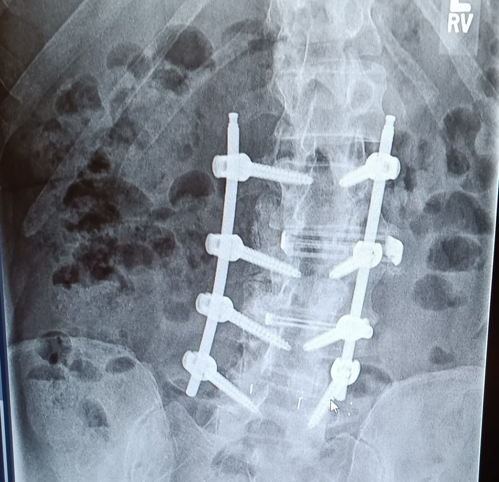 Patient image of: Keith Walters