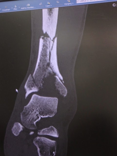 Patient image of: Adam Turteltaub