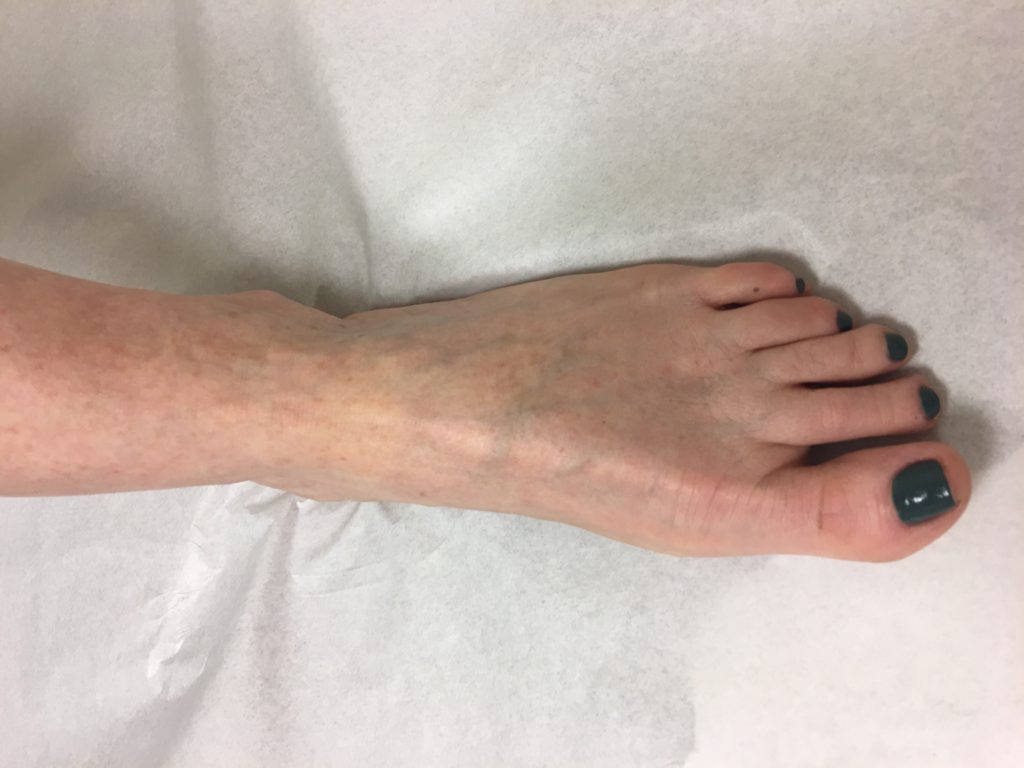 Patient image of: Alice 