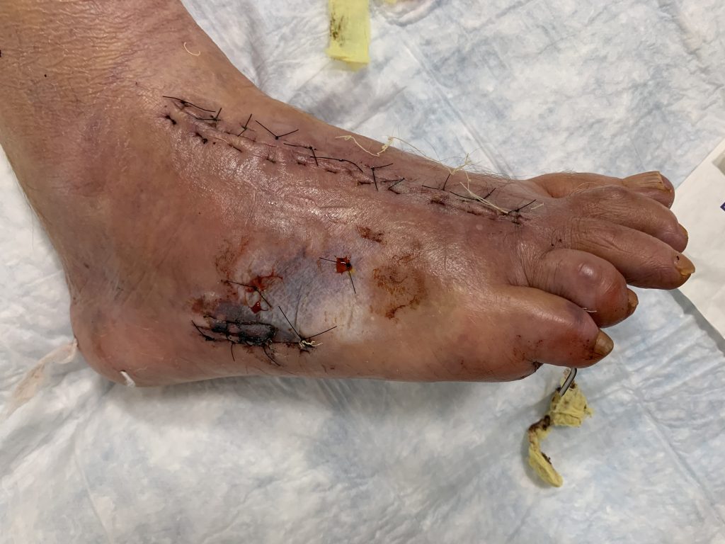 Patient image of: Ramon Gilsanz