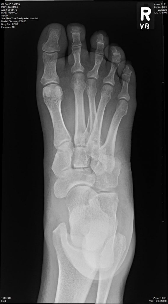Patient image of: Ramon Gilsanz