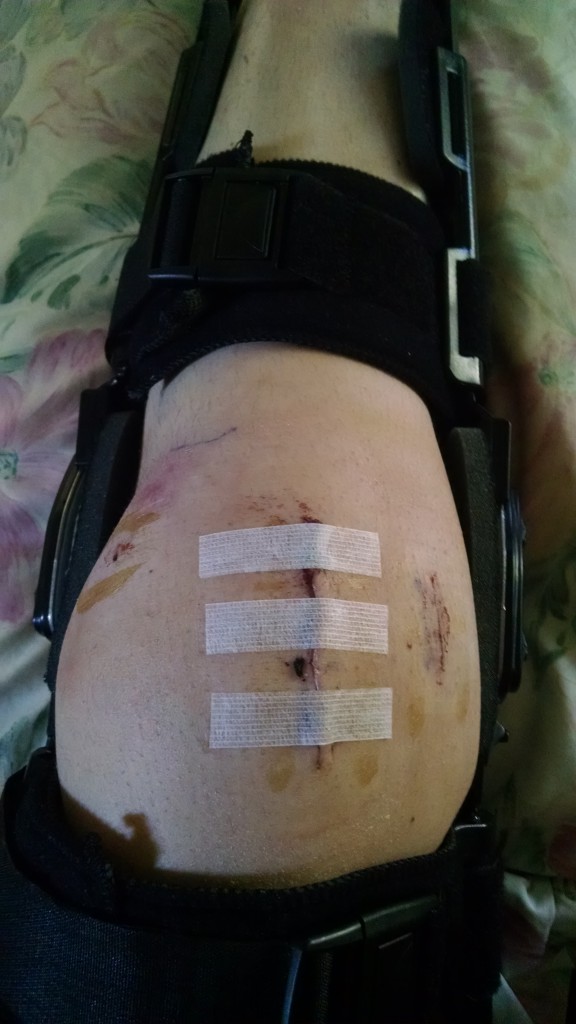 Patient image of: Laura Carhart