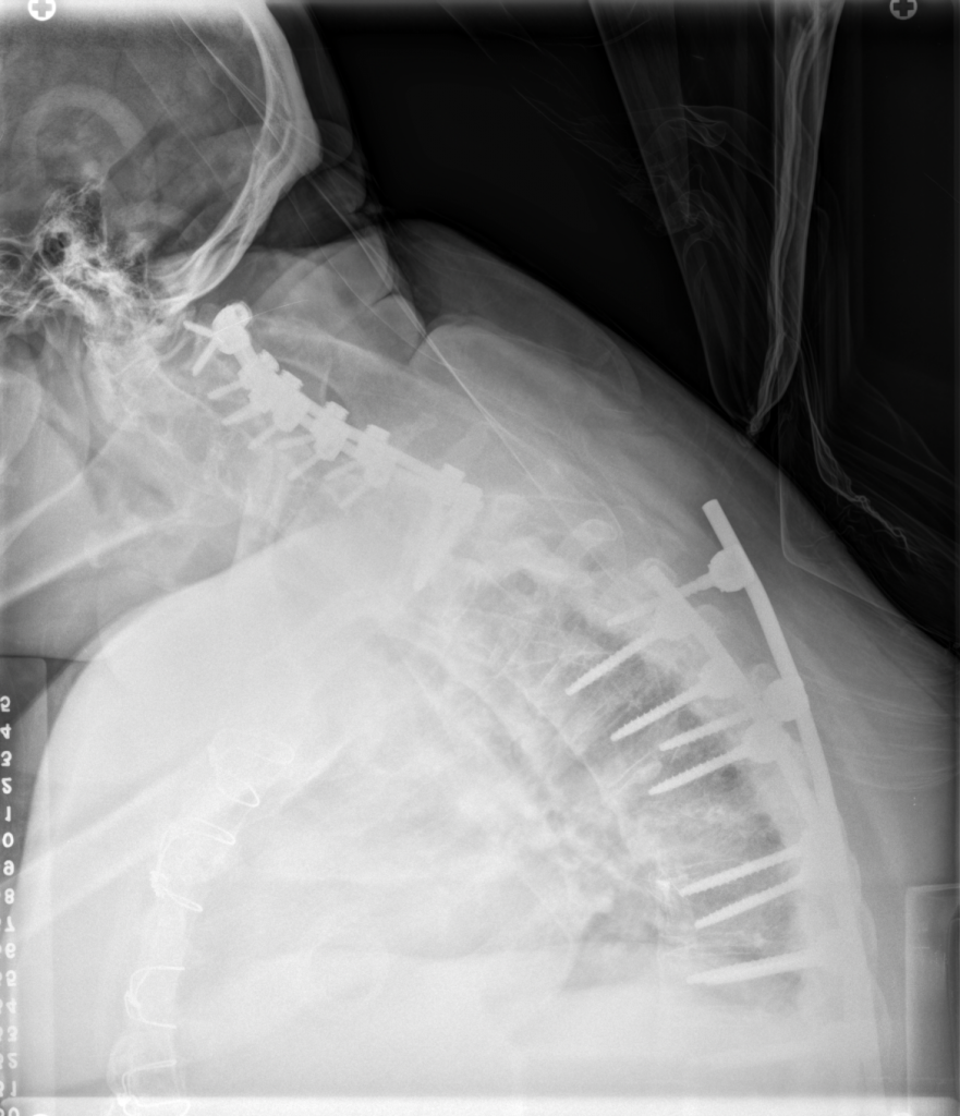 Patient image of: Susan 