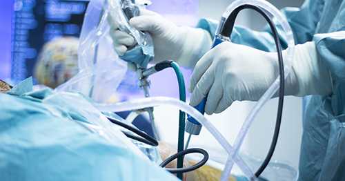 A surgeon performing knee arthroscopy