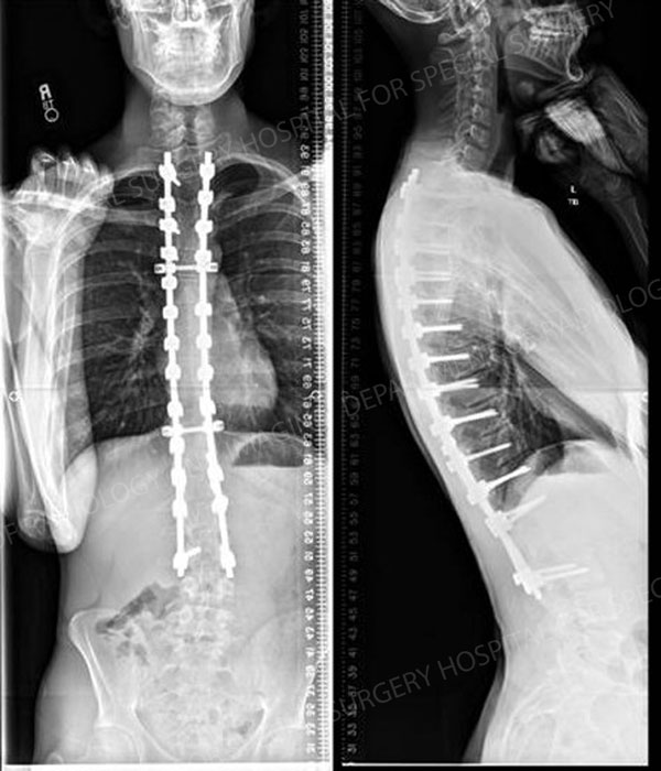 Post operative x-ray images