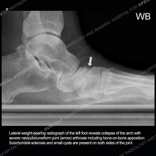 Ultrasound Case 179