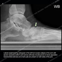 Ultrasound case 179 thumbnail