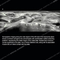 Ultrasound thumbnail image of case 187