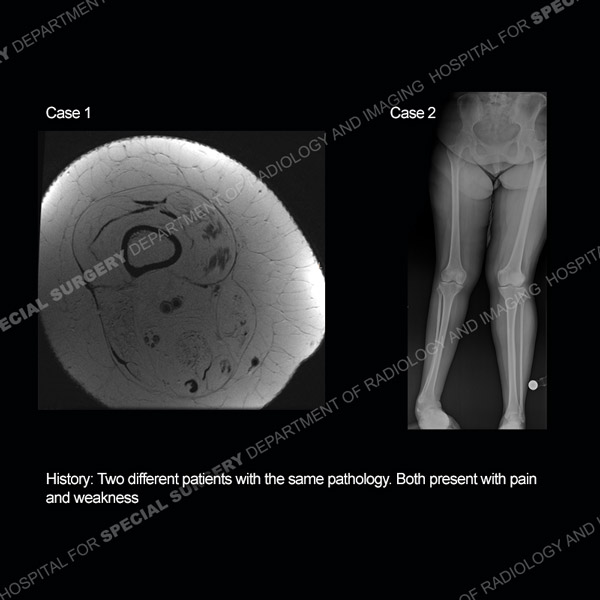 Diagnosis Case 209