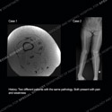 what's the diagnosis thumbnail case 209