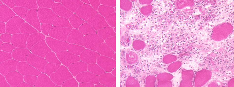 neurology research slides